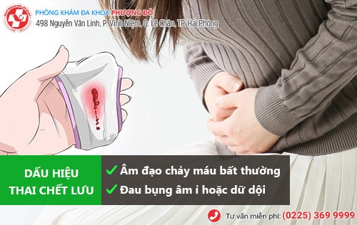 Cách nhận biết thai chết lưu và cách khắc phục