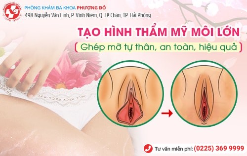 Thẩm mỹ vùng kín: Nên hay không?