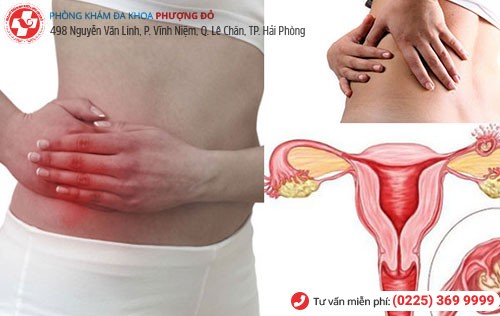 Dấu hiệu viêm buồng trứng giai đoạn đầu