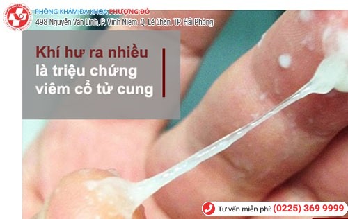 Viêm cổ tử cung khiến khí hư ra nhiều