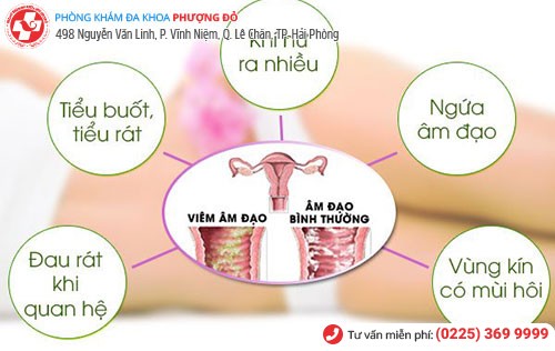 Một số triệu chứng cơ bản khi bị viêm phụ khoa