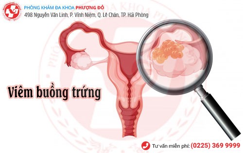 Viêm buồng trứng