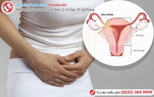 Các triệu chứng viêm phần phụ chị em nên lưu ý