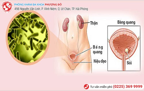 đường tiết niệu ở nữ