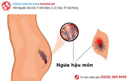 Dấu Hiệu Apxe Hậu Môn 