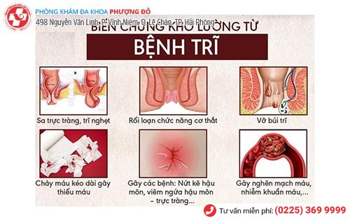 Những biến chứng nguy hiểm khi mắc bệnh trĩ