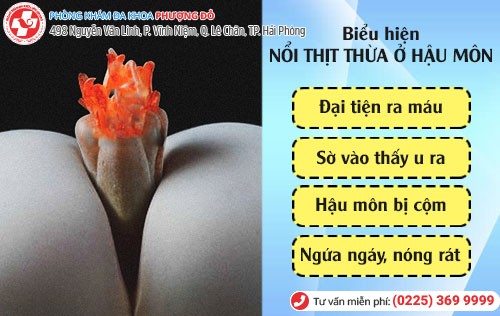 Biểu hiện nổi thịt thừa ở hậu môn