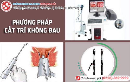 Phương pháp cắt trĩ không đau Hải Phòng