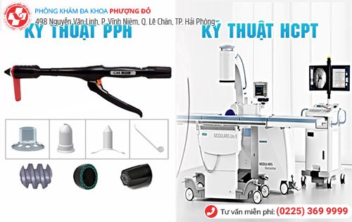 chữa trĩ bằng phương pháp PPH và HCPT