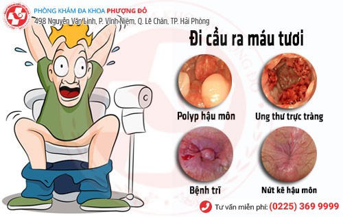 Đi cầu ra máu tươi là bệnh gì?