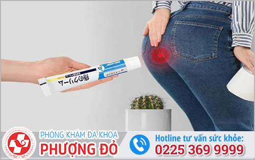 Cách điều trị nấm hậu môn