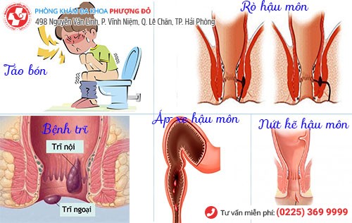 Nguyên nhân đau rát hậu môn