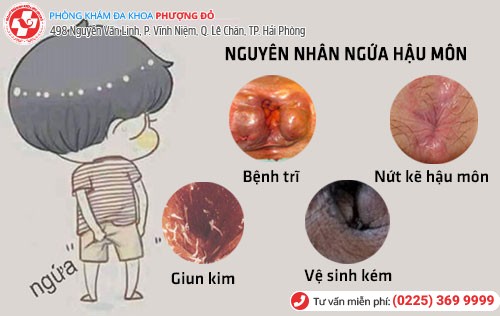 Nguyên nhân ngứa hậu môn