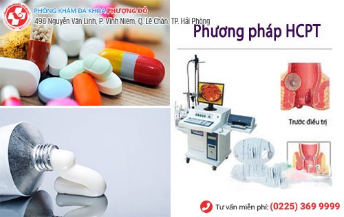 Phương pháp trị bệnh trĩ