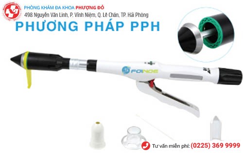 Phương pháp PPH chữa trĩ