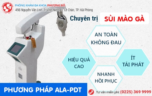 Chi tiết bệnh sùi mào gà ở nữ giai đoạn đầu