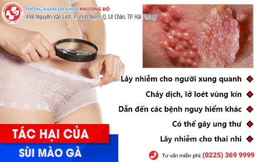 Chi tiết bệnh sùi mào gà ở nữ giai đoạn đầu