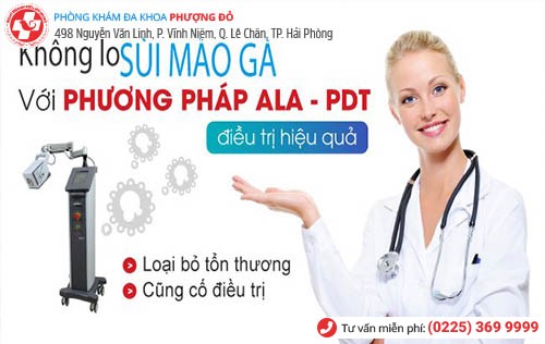 chữa sùi mào gà bằng ala pdt