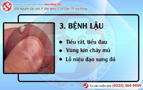 Bệnh hoa liễu bệnh lậu