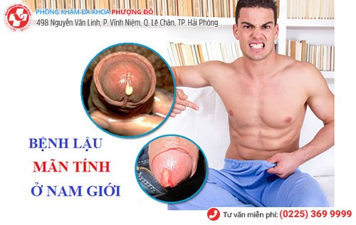 Hình ảnh lậu giai đoạn mãn tính ở nam