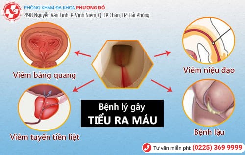 bệnh lý gây tiểu buốt ra máu