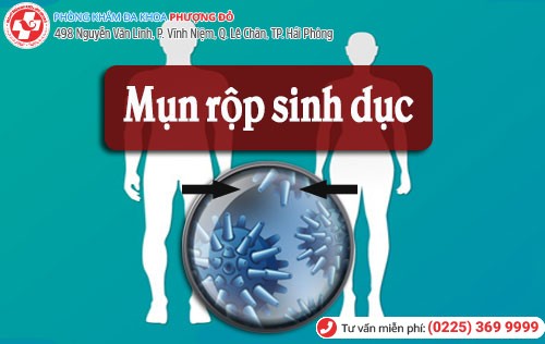 Mụn rộp sinh dục