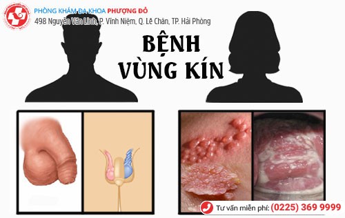 Bệnh vùng kín ở cả nam và nữ