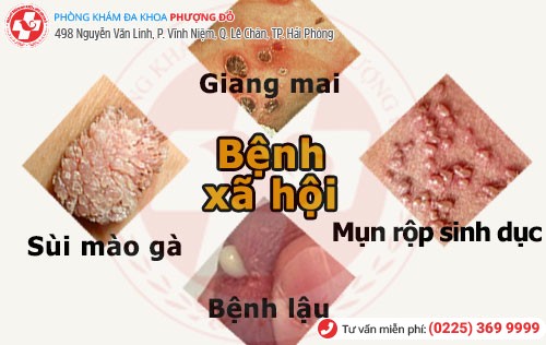 Hình ảnh bệnh xã hội