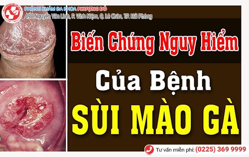 Ung thư dương vật, cổ tử cung - biến chứng nguy hiểm nhất khi nhiễm virus HPV