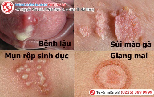 4 loại bệnh xã hội nguy hiểm hiện nay