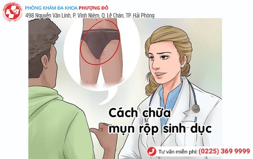 cách chữa mụn rộp sinh dục