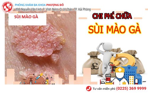 Chi phí chữa sùi mào gà phụ thuộc nhiều yếu tố khác nhau