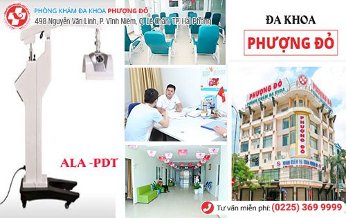 ALA - PDT - phương pháp chữa sùi mào gà tiên tiến hiện nay