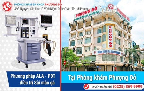 Hiểu rõ hơn về sùi mào gà ở mắt