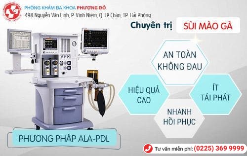 chữa sùi mào gà ở nữ