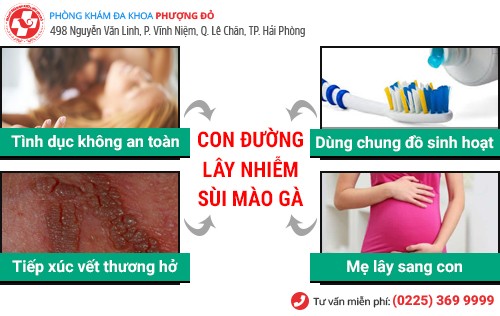 [Bạn hỏi – Bác sĩ trả lời] – Sùi mào gà có lây hay không?