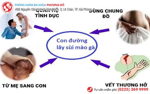 Sùi mào gà có tốc độ lây nhiễm nhanh