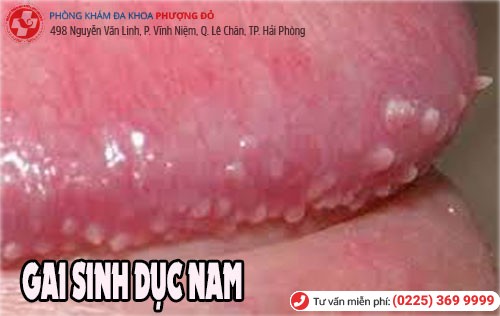 Gai sinh dục nam giới