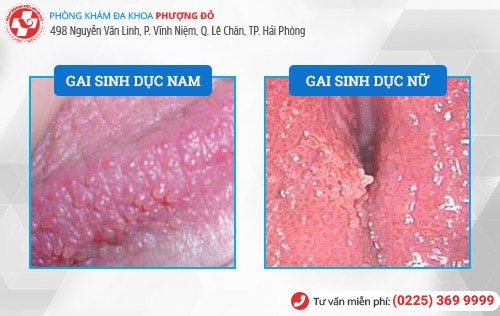 gai sinh dục