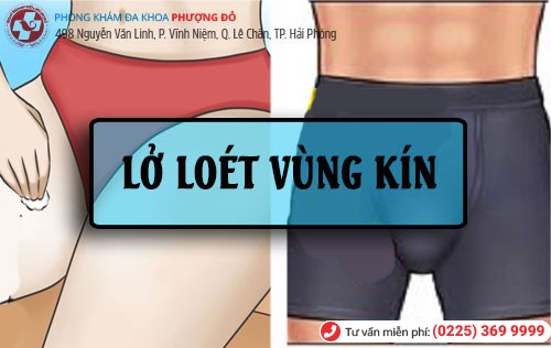 Lở loét vùng kín