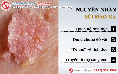 Nguyên nhân sùi mào gà