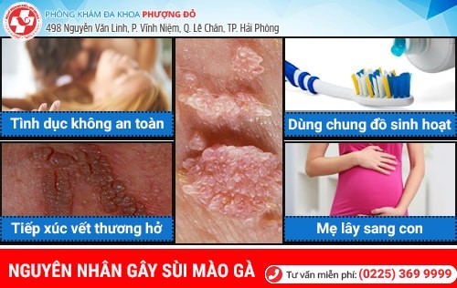 nguyên nhân sùi mào gà