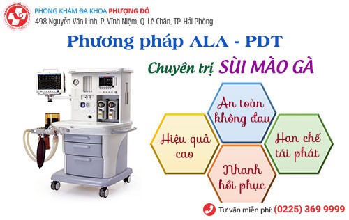 Phương pháp ALA - PDT chữa sùi mào gà được xem là phác đồ tiên tiến hiện nay