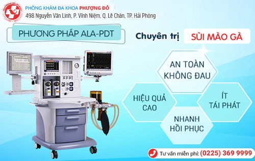 Phương pháp ALA-PDT hỗ trợ điều trị sùi mào gà