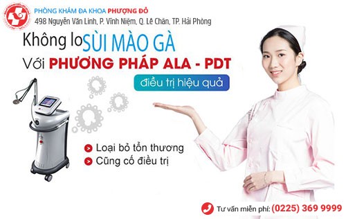 ALA-PDT là phương pháp chữa sùi mào gà tiên tiến nhất hiện nay