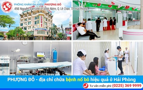 Bệnh nổ bô là gì? Phương pháp chữa bệnh nổ bô an toàn hiện nay