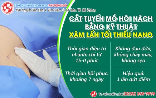 Cắt tuyến mồ hôi nách liệu có phải là giải pháp an toàn?