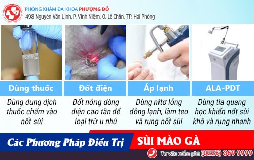 Biểu hiện sùi mào gà trên từng vị trí cơ thể dễ nhận biết sớm nhất