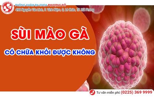 Sùi mào gà có chữa được không phụ thuộc nhiều yếu tố