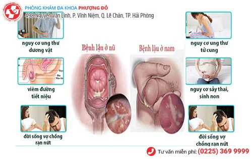 Thoát khỏi bệnh lậu nhờ phương pháp này!